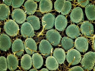 Actinomycetes