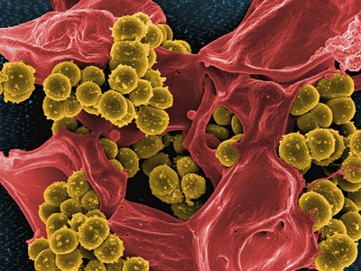 Cryoconite Microbes