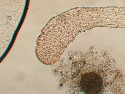Nematodes