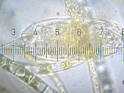 Rotifers