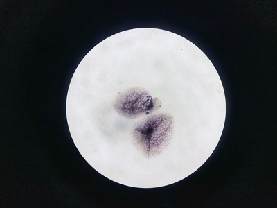 Testate Amoebae