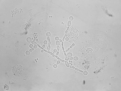 Yeast-like Fungi
