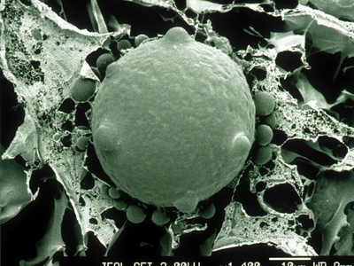Chytrid Fungus