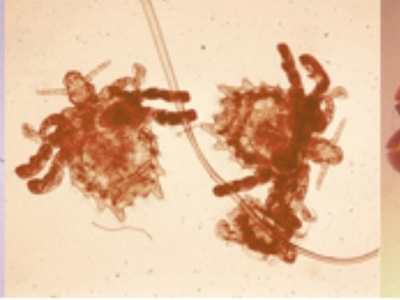 Louse