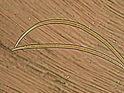 Pine Wood Nematode