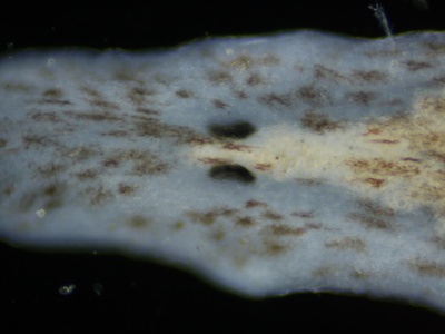 Freshwater flatworm