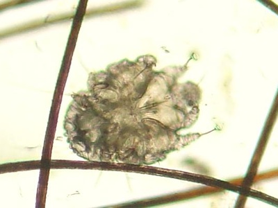 Scabies mite