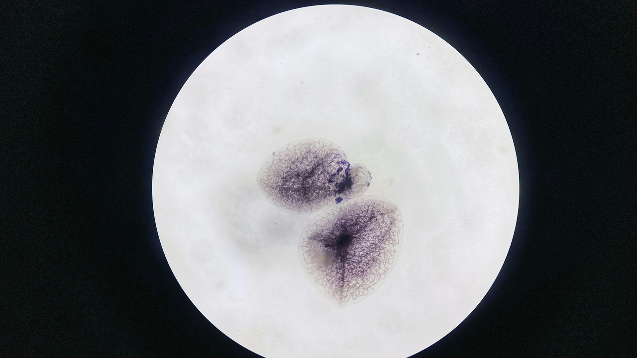 Mycologist examining spores under a microscope and lab sequences for DNA barcoding