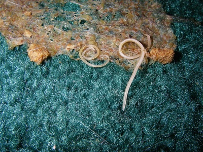 Nematode (Roundworm)
