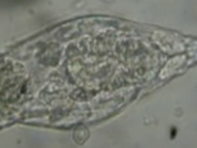 Rotifer (Wheel Animal)