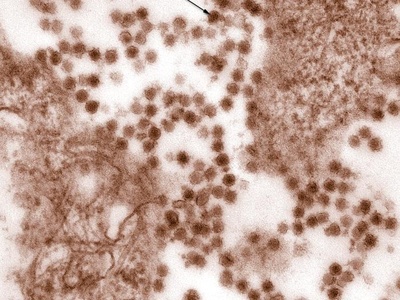 West Nile virus