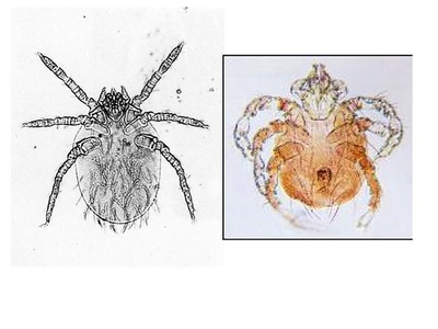 Chigger mite