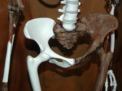 Australopithecus afarensis