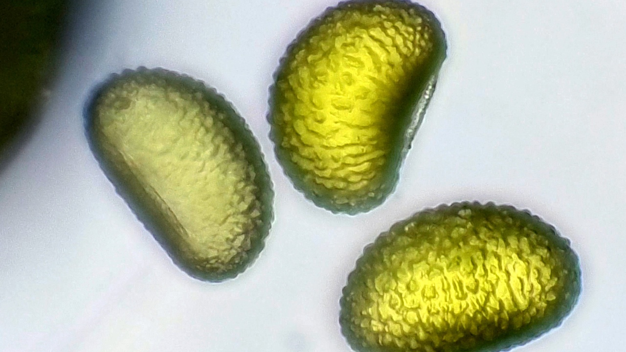 Fern sori on the underside of a frond with close-up of sporangia and spores