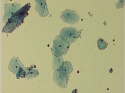 Gardnerella