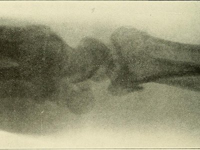 Greater Electric Ray