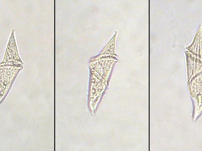 Gyrodinium