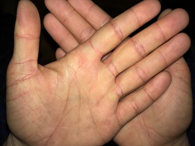 Vola Vola Palm